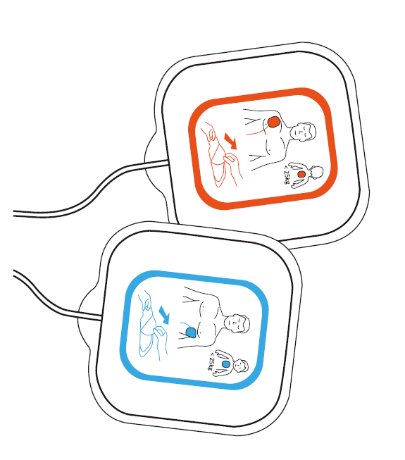 Défibrillateur Semi-Automatique Reanibex 100 – Image 4