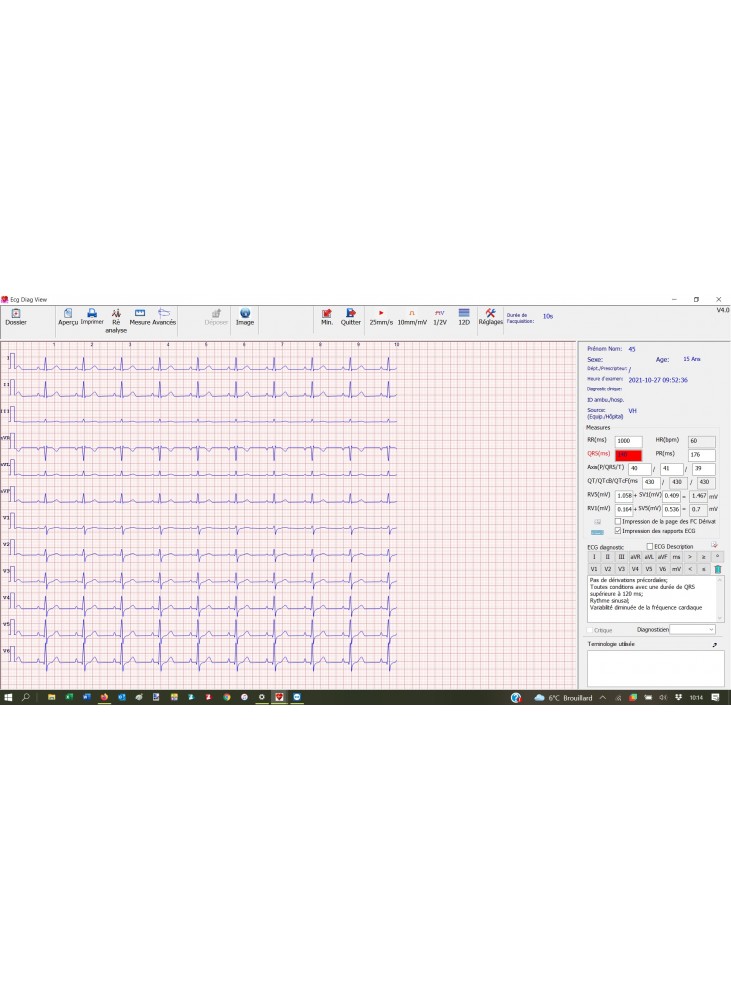 ECG PORTABLE NUMERIQUE PC – Image 2