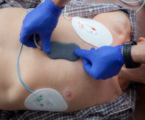 Moniteur Défibrillateur Reanibex 300, ECG 12 dérivations-GSM - Bexen Cardio – Image 3